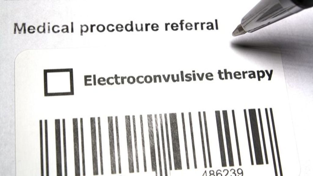 Un 80% de casos sobre enfermedades mentales graves son eliminados con terapia electroconvulsiva