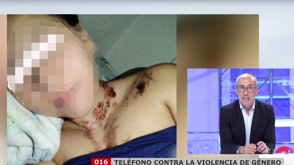 Secuestrada, torturada y maltratada por su novio en Barcelona: “Es sadismo puro y duro”