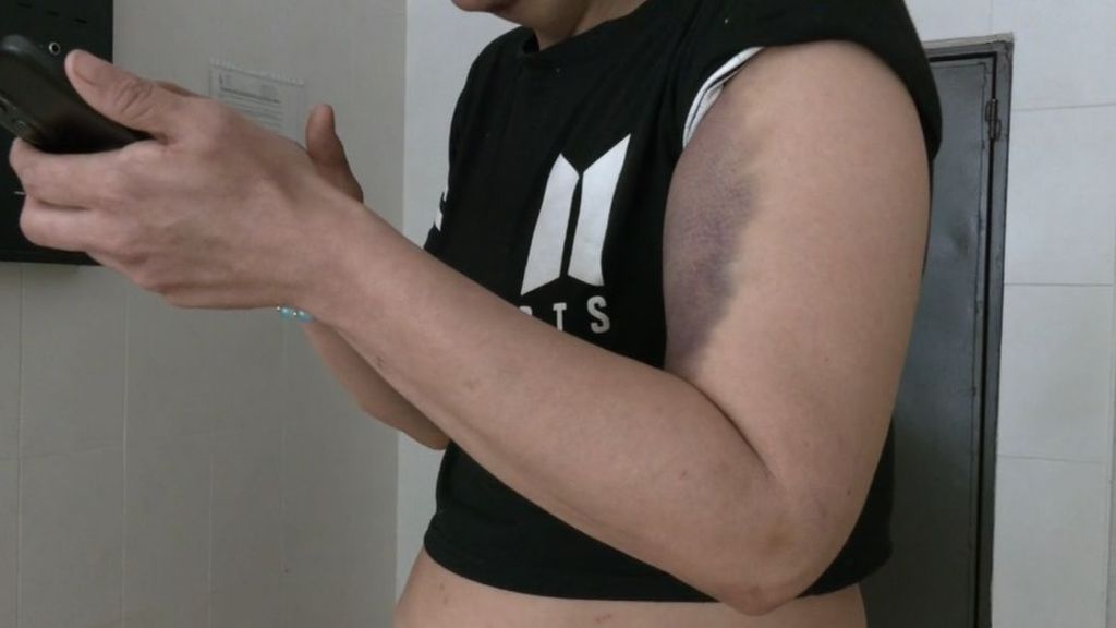 Denuncian el maltrato que sufre su madre gracias a una foto de sus golpes en Sevilla: su pareja, detenida