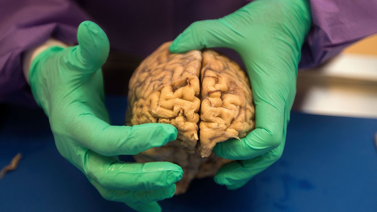 Donar el cerebro es posible y puede salvar vidas