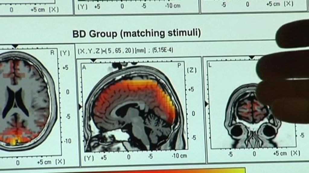 Los países más machistas impiden el desarrollo del cerebro de las mujeres