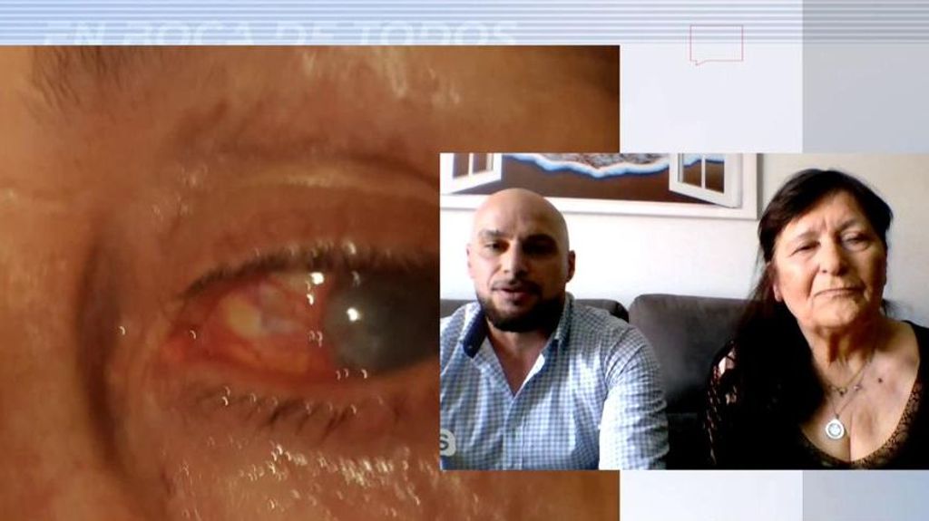 Una mujer ha estado 58 años con una piedra en el ojo: "Los médicos no me creían. Salía llorando de todas las consultas"