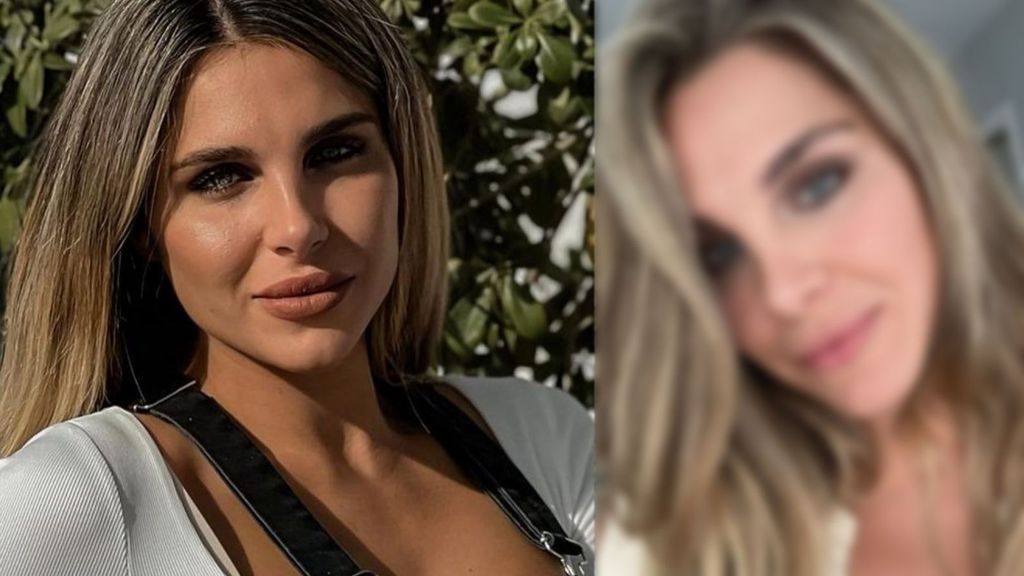 Ivana Icardi se retira el ácido hialurónico de sus labios y explica el motivo: su llamativo antes y después