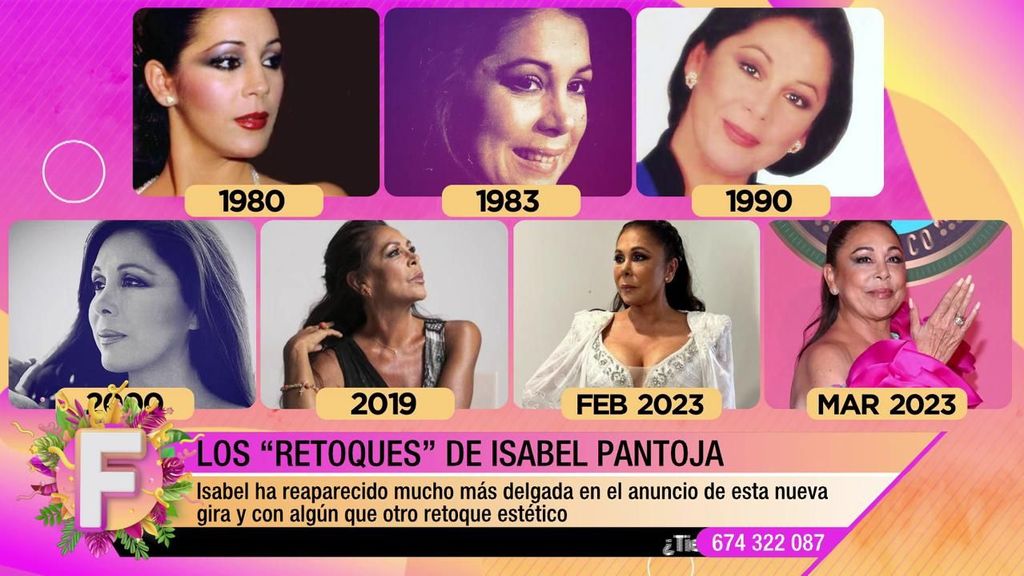 Los retoques estéticos de Isabel Pantoja