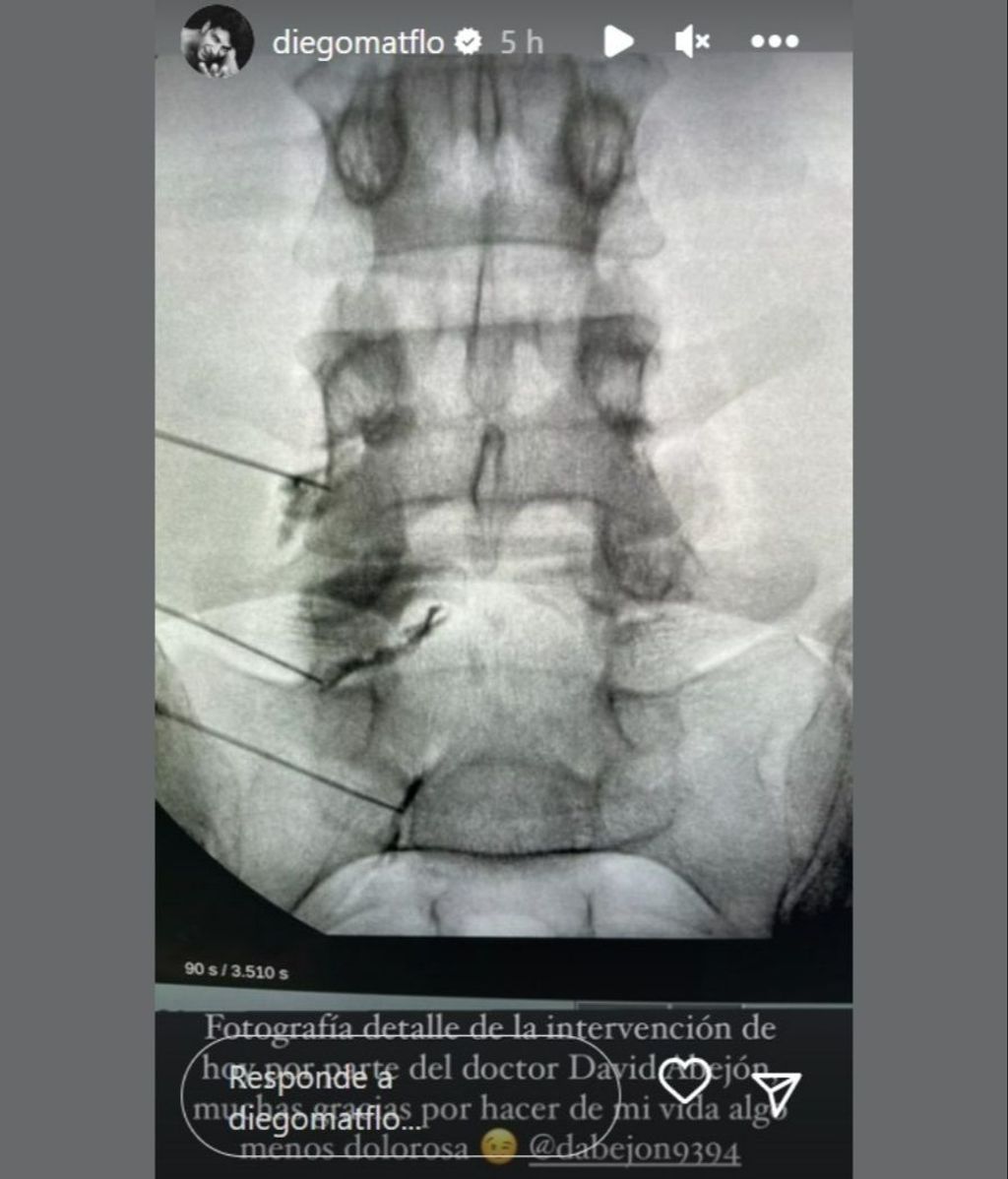 Diego Matamoros comparte una radiografía de su columna vertebral