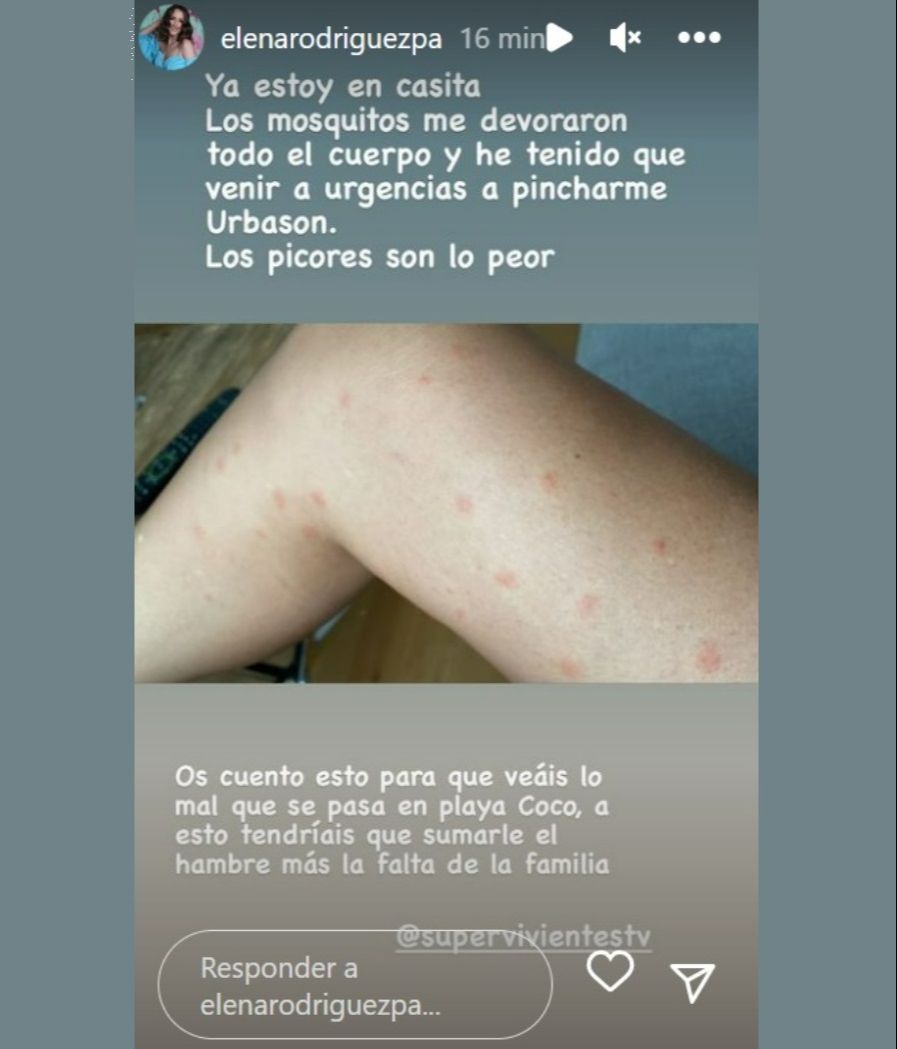 Elena muestra sus picaduras