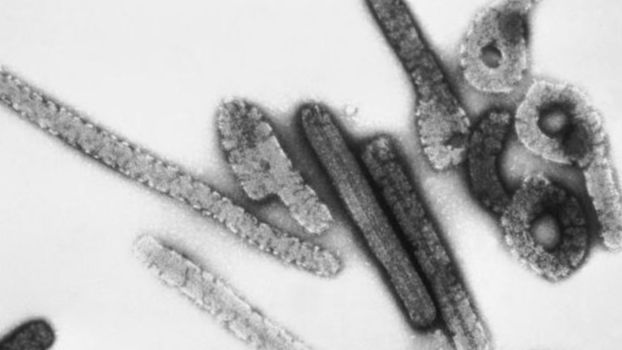 The suspected case of hemorrhagic fever in Cantabria exams damaging in Marburg, Ebola and Lassa