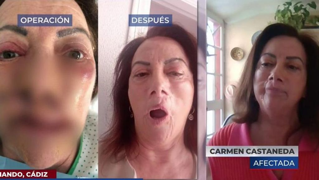 Carmen denuncia al Servicio Andaluz de Salud: "Siento cada día crecer el cáncer en mi cara, necesito que me ayuden"