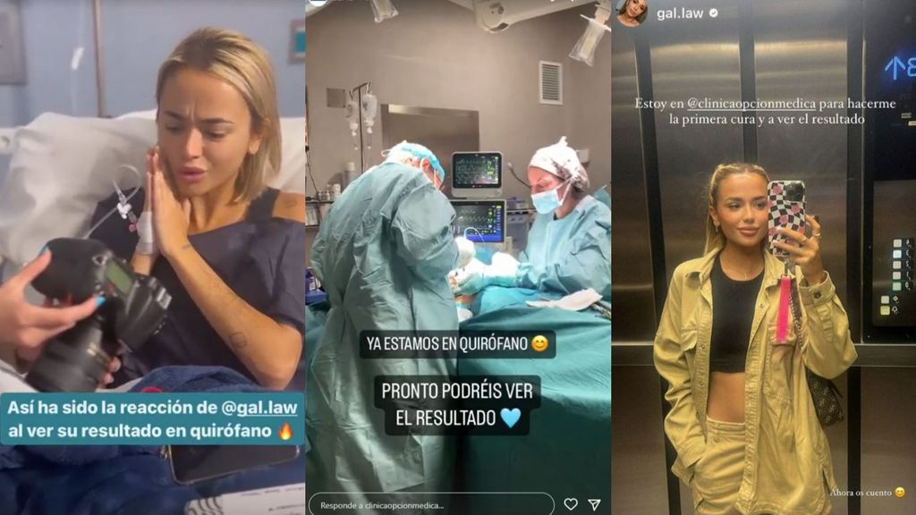 Gal·la Mora comparte las primeras imágenes tras su nueva operación de pecho