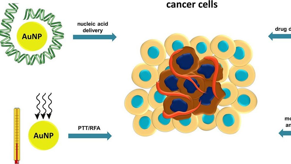 Desarrollan unos microgeles con nanopartículas de oro que permiten diagnosticar tumores.