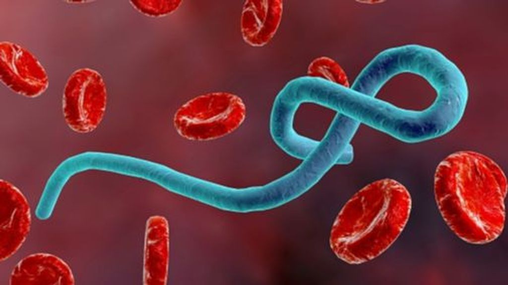 Un posible caso de ébola, en estudio en el País Vasco