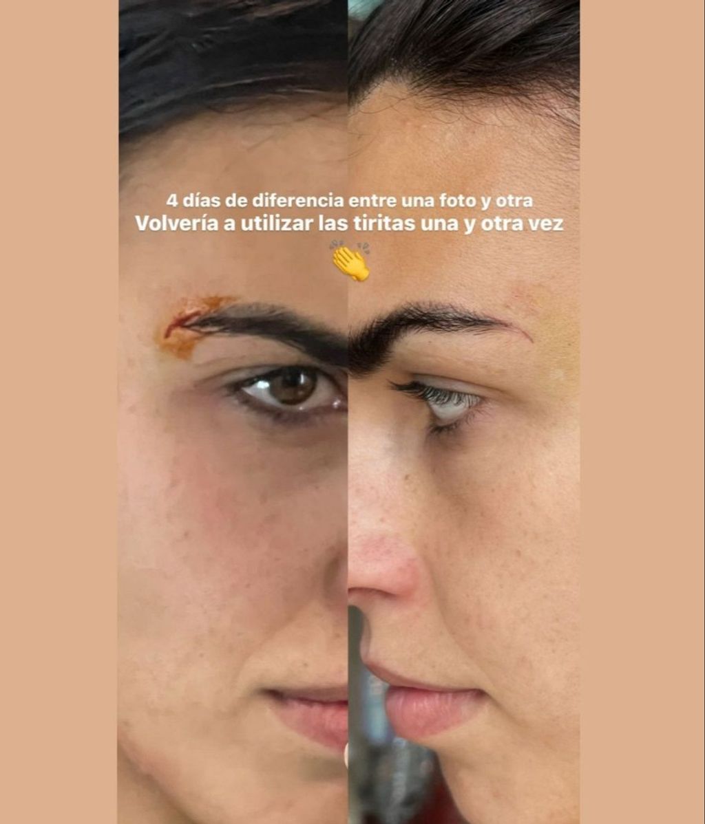 Sofía Suescun muestra la cicatriz de su herida en la ceja