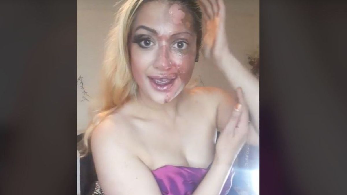 Una mujer se quema el rostro al emplear un truco viral para ahorrar tiempo en la cocina