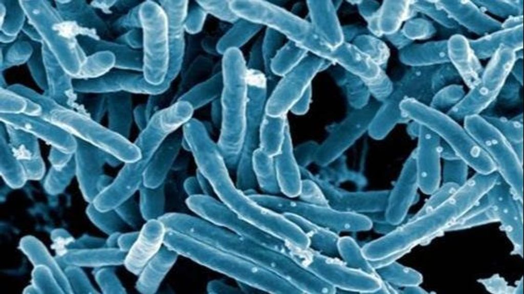 Alerta por tuberculosis en Ourense: detectan 19 casos positivos de tuberculina en un instituto