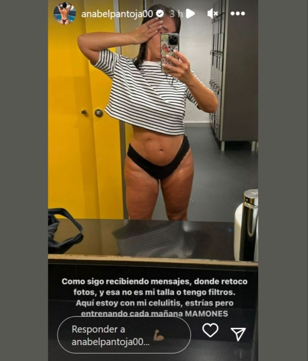 Anabel Pantoja muestra la realidad de su cuerpo