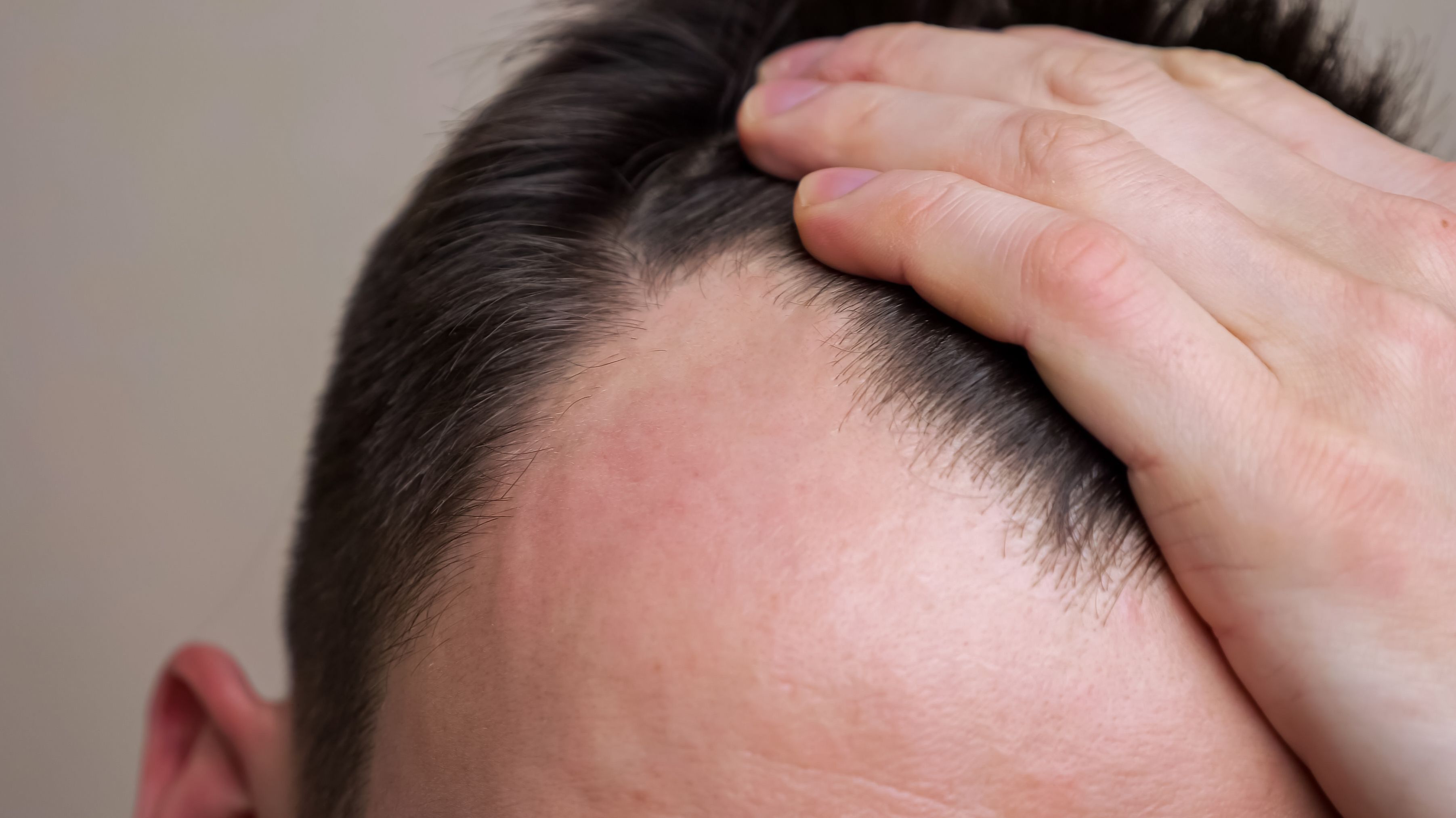 Por qué motivos se cae el pelo