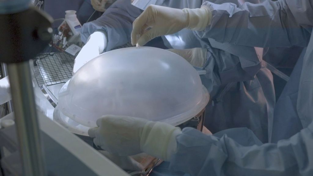 Crean una placenta artificial para "prematuros extremos" que logra 12 días de supervivencia en animales