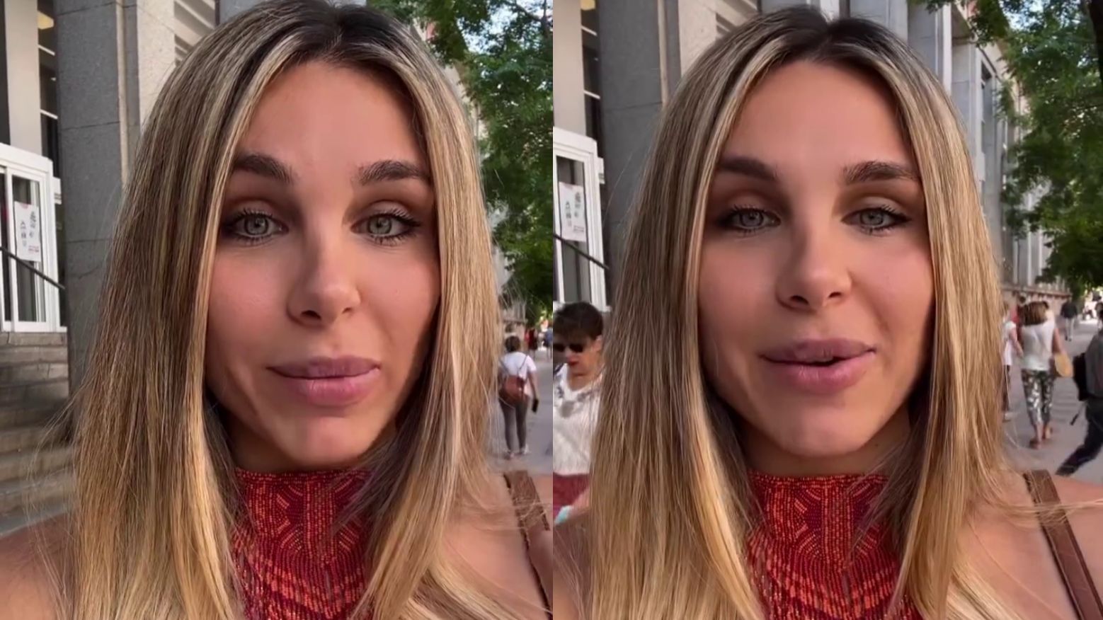 Ivana Icardi enseña cómo tiene la nariz un año después de la rinoplastia