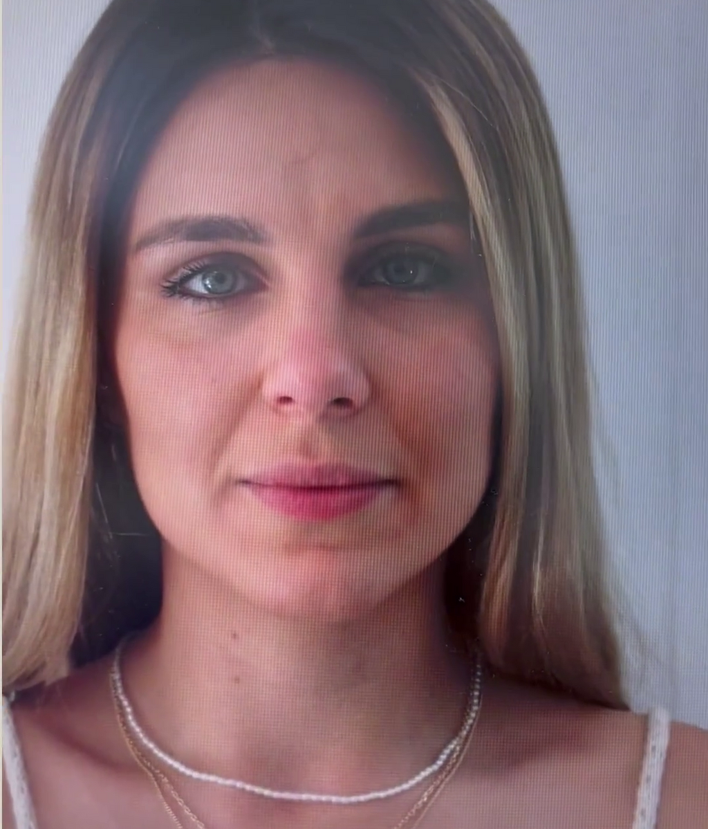 La nariz de Ivana Icardi antes de la rinoplastia