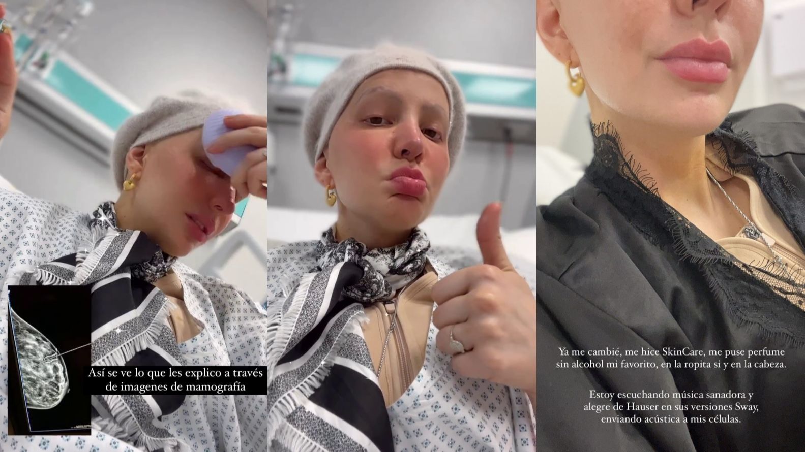 Aylén Milla explica cómo ha ido su intervención quirúrgica