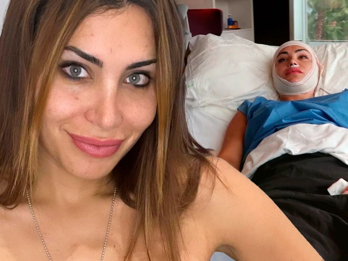 Daniela Requena se lima los huesos del cráneo: la cirugía estética que ha  cambiado su rostro - Pesadilla en el paraíso