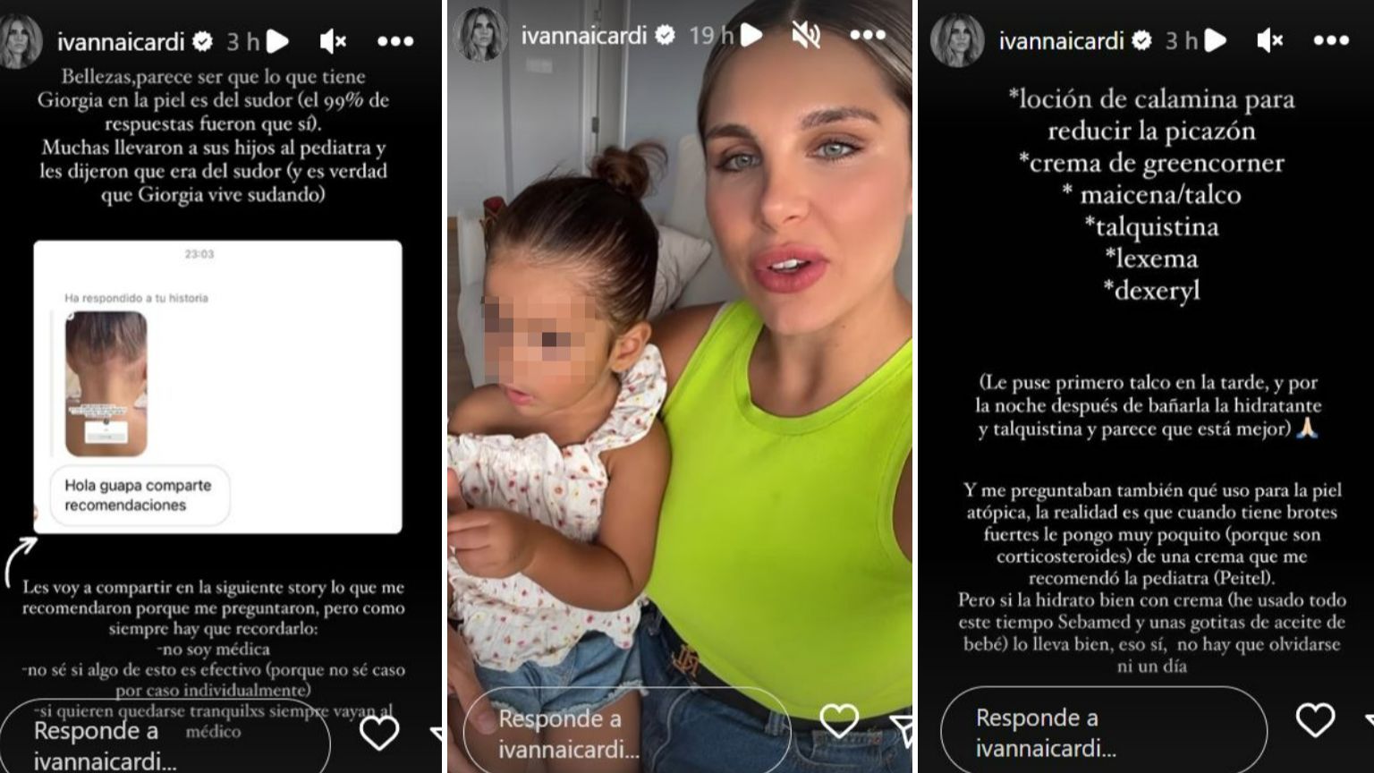 Las soluciones que le han dado a Ivana Icardi sus seguidores con el problema en la piel de Giorgia