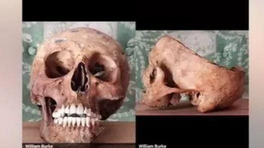 Las calaveras que vendía James Nott en sus redes sociales