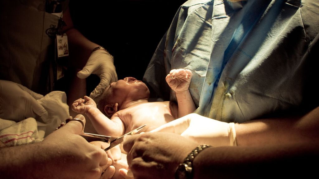 Un médico corta elcordón umbilical a un recién nacido