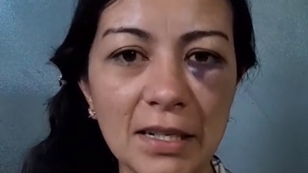 Dalia, profesora víctima de la agresión