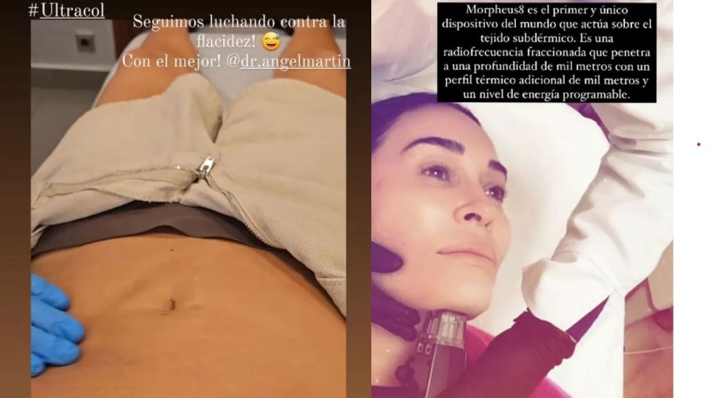 La mujer de David Bisbal, Rosanna Zanetti, se somete a un tratamiento para  eliminar la flacidez tras sus dos embarazos