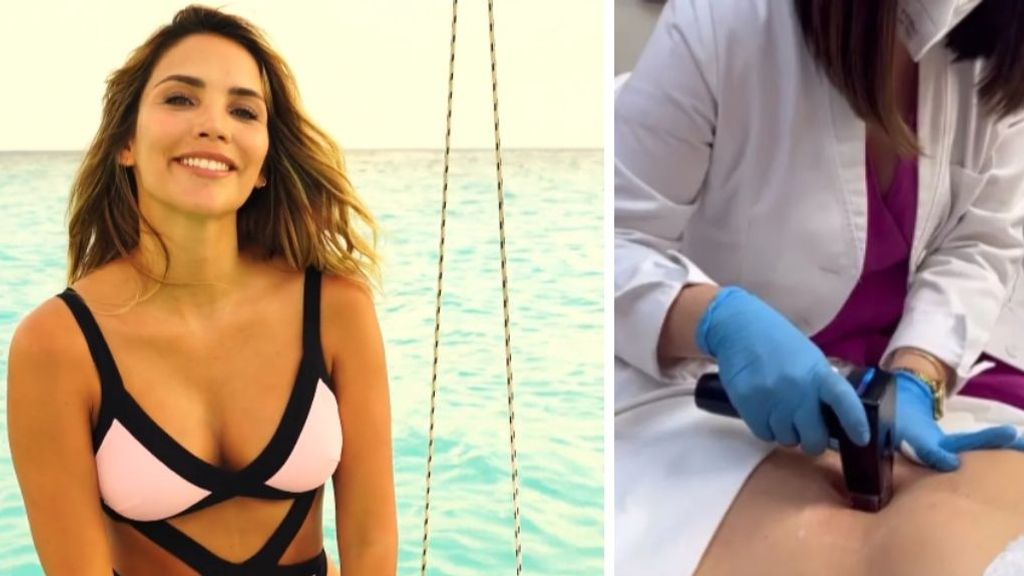 Rosanna Zanetti muestra la flacidez de su abdomen tras sus dos embarazos