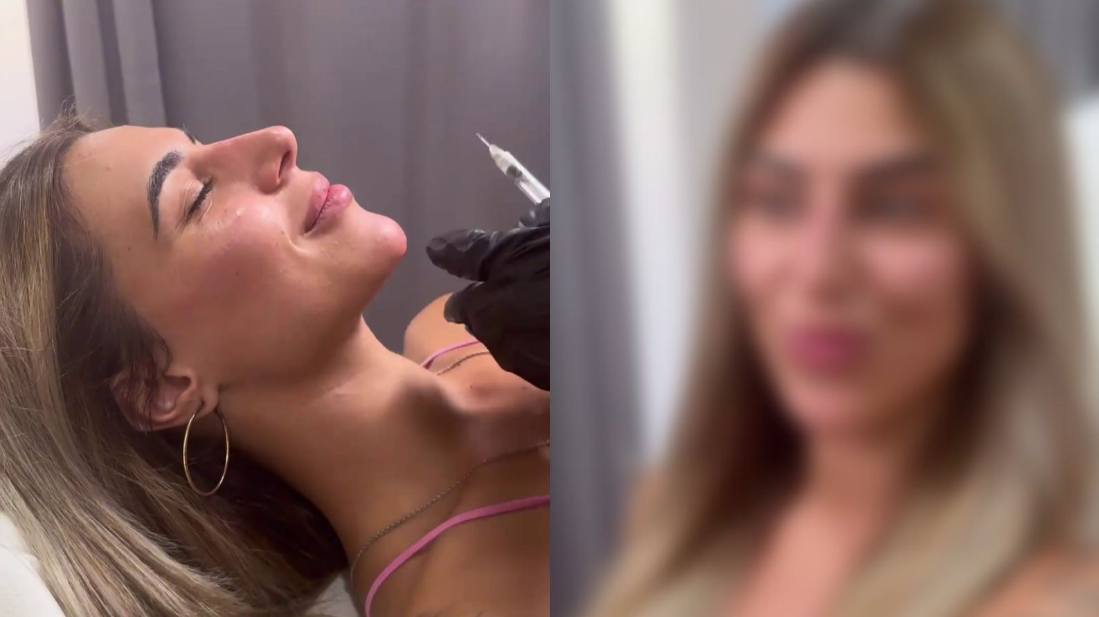 El antes y el después de Bea Retamal tras hacerse varios retoques estéticos en el rostro