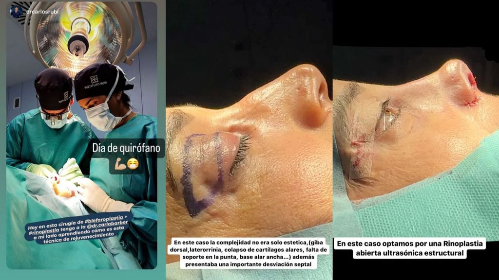 El doctor Carlos Rubí presume de la compañía que ha tenido en su último y complejo día de quirófano