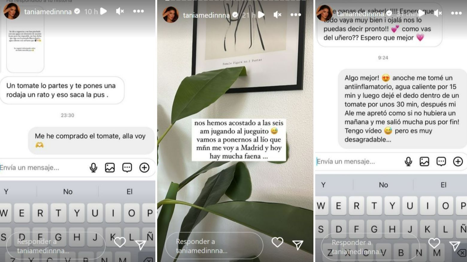 Los remedios caseros que Tania Medina está funcionando para curar su infección