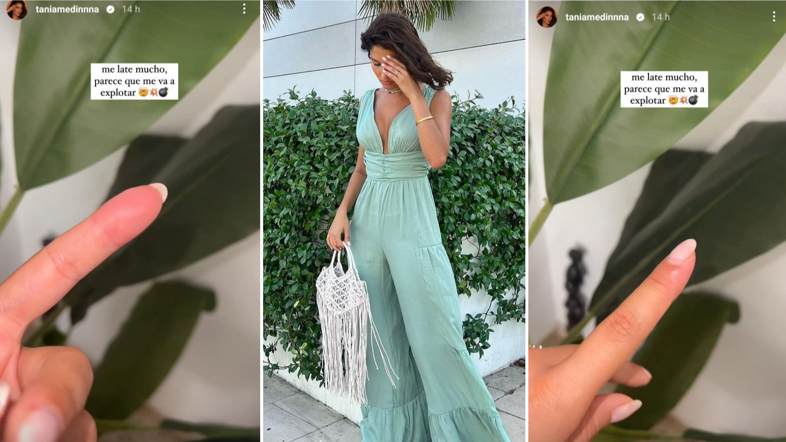 Tania Medina enseña la paroniquia o infección de la piel alrededor de una uña que le ha salido