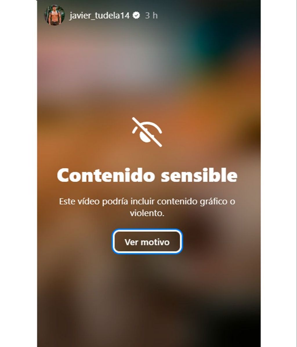 Instagram censura por contenido sensible la operación de Javier Tudela