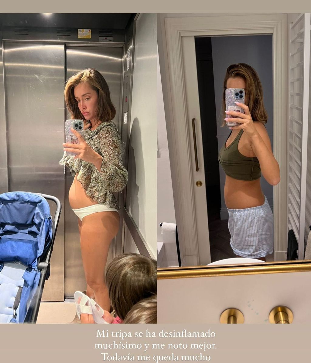 El antes y el después de Adara Molinero tras su nueva dieta