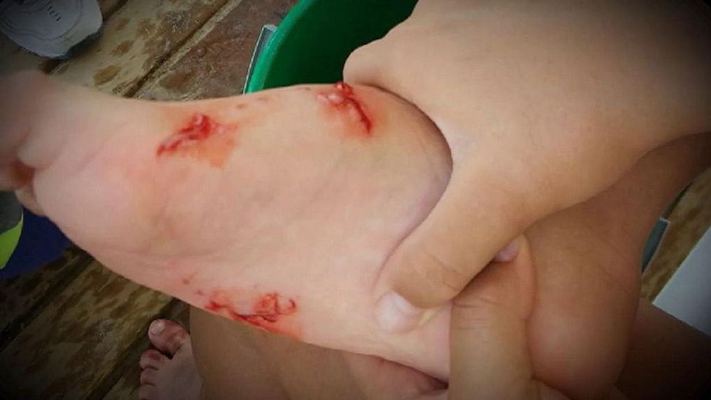 Un pez globo carnívoro ataca a una familia en Canarias: “Ha mordido a mi mujer y a mi hijo”