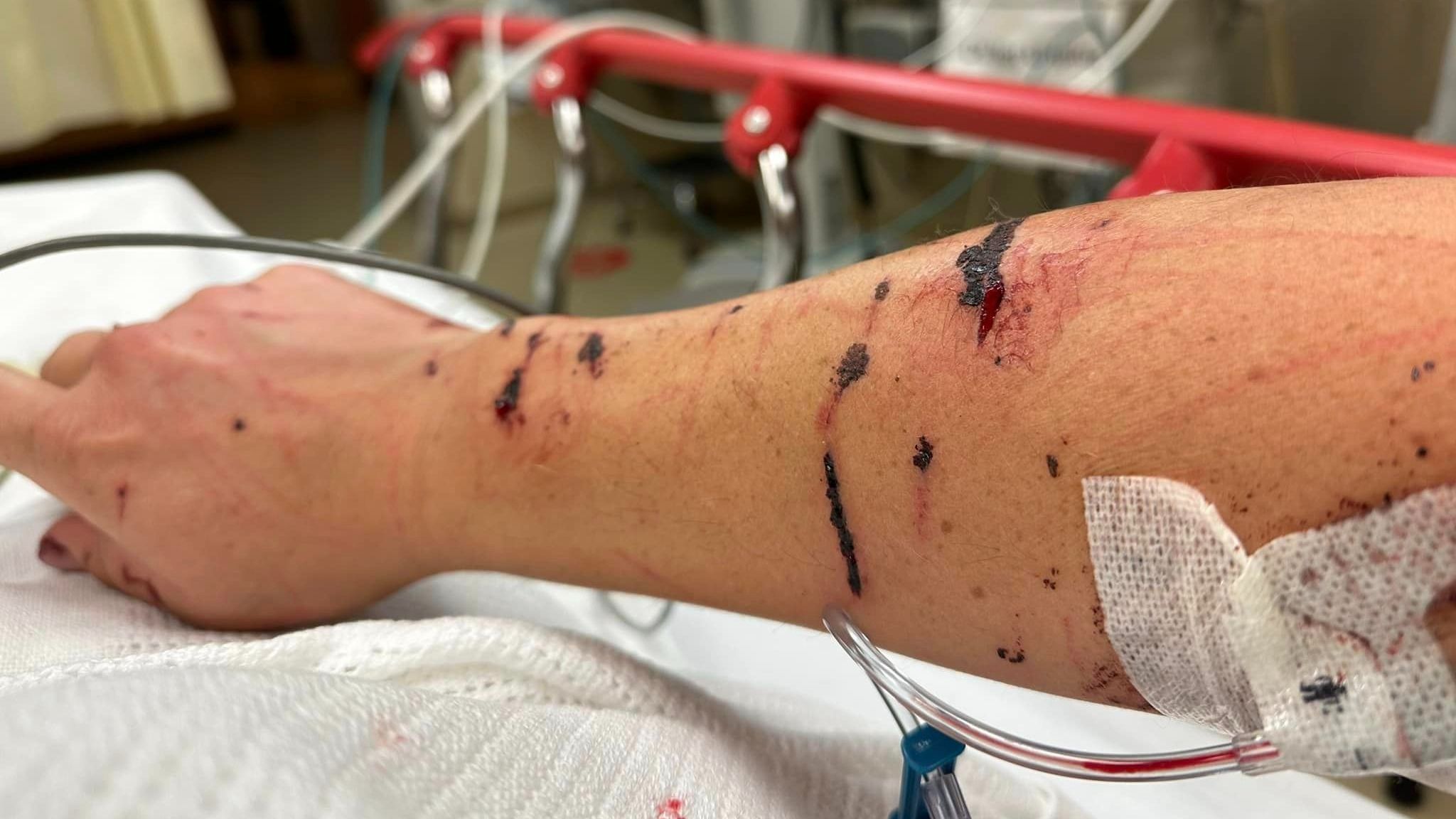 Una mujer pierde la mitad de su oreja derecha por el ataque de una nutria en un río de Estados Unidos