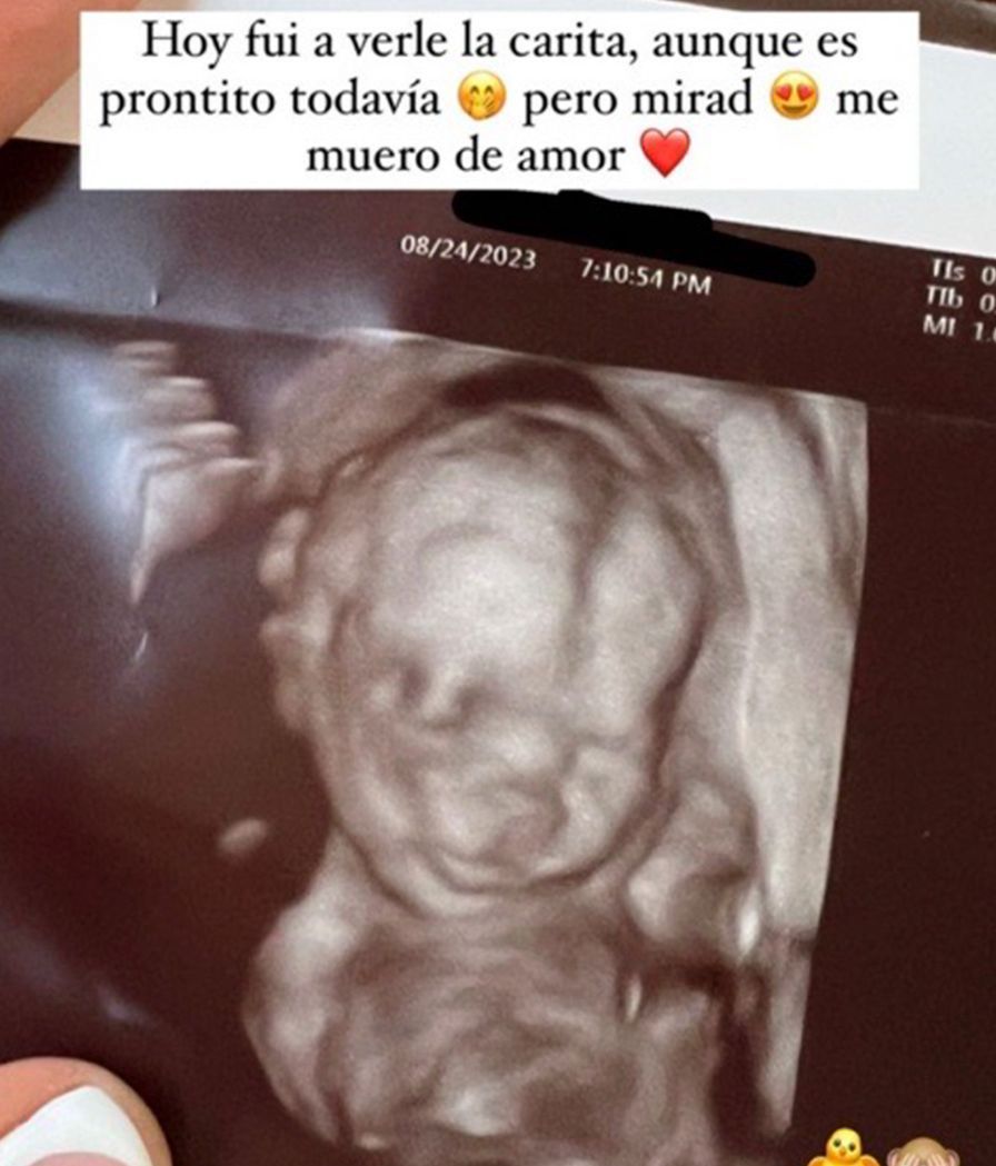 Lara Tronti y Hugo Pérez ven la cara de su bebé