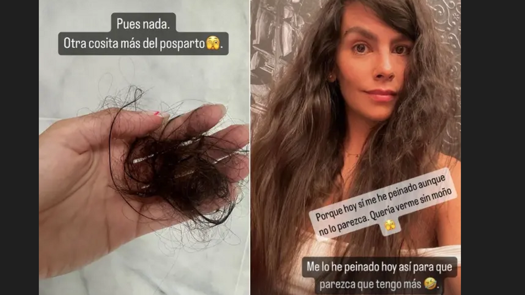 Cristina Pedroche muestra su caída de pelo