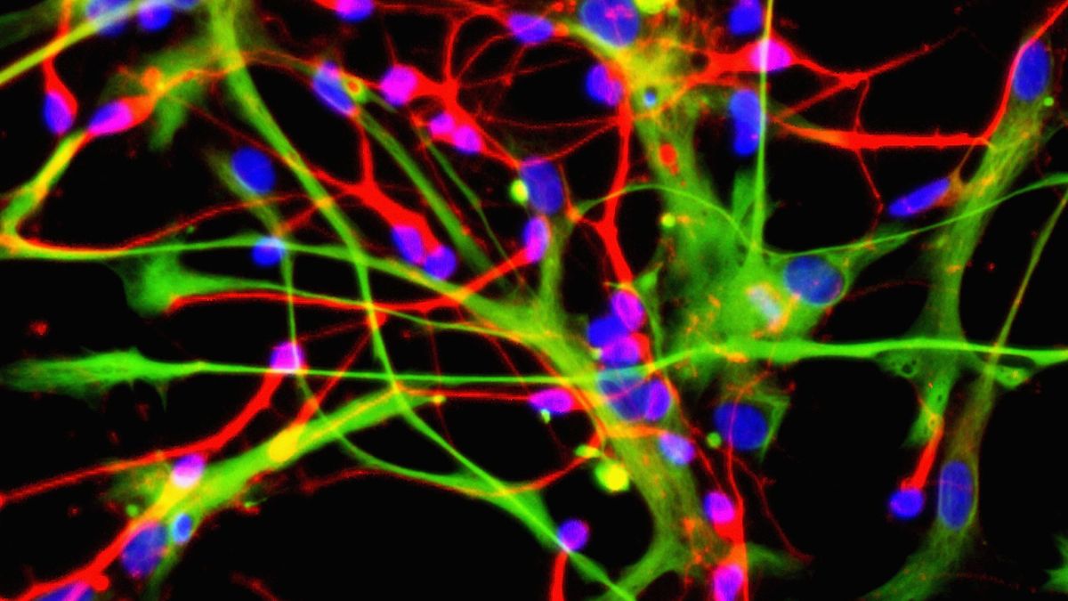 Recreación de un conjunto de células cerebrales: neuronas, gliales y astrocitos