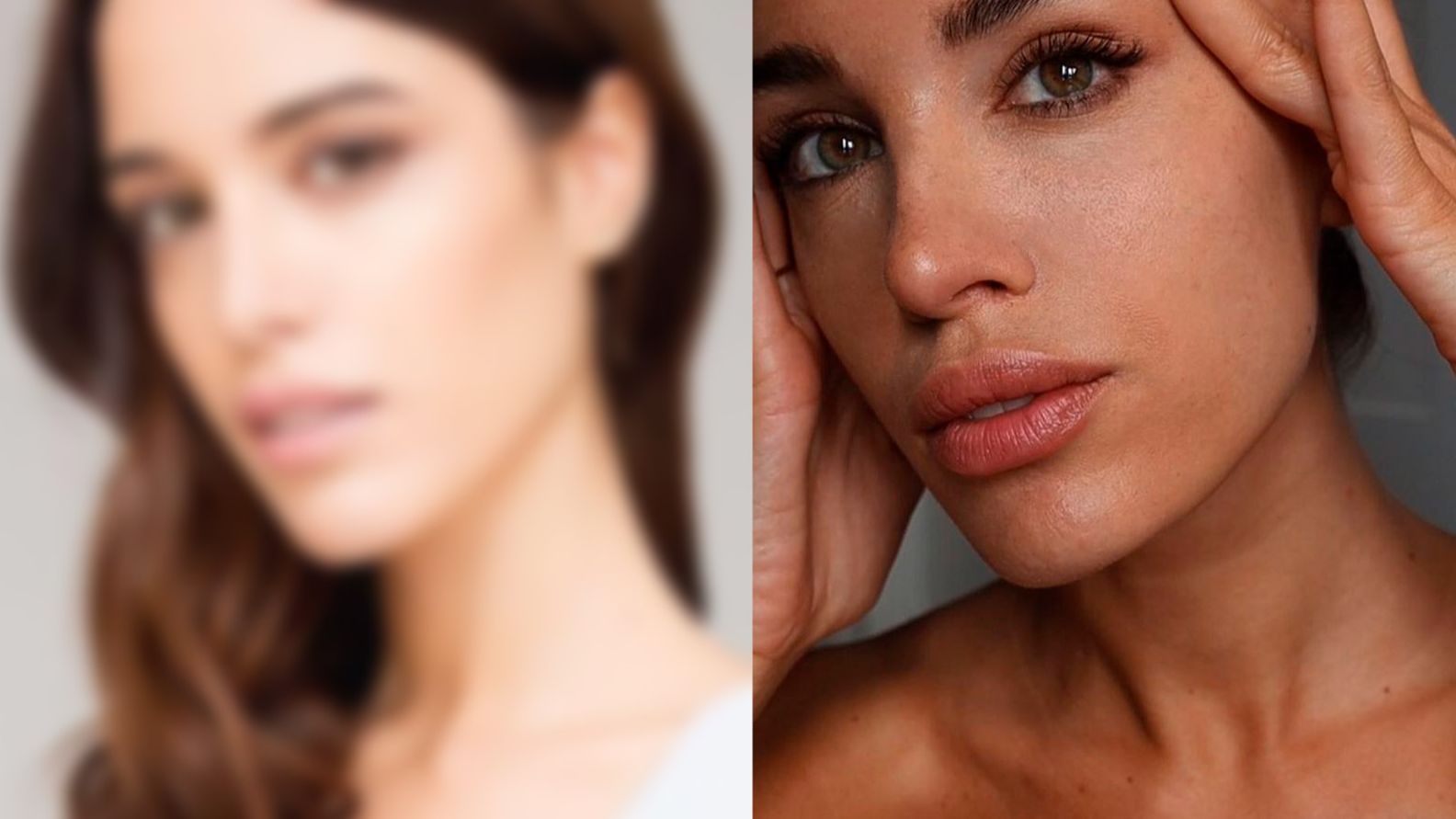 Teresa Bass, antes y después de sus operaciones estéticas