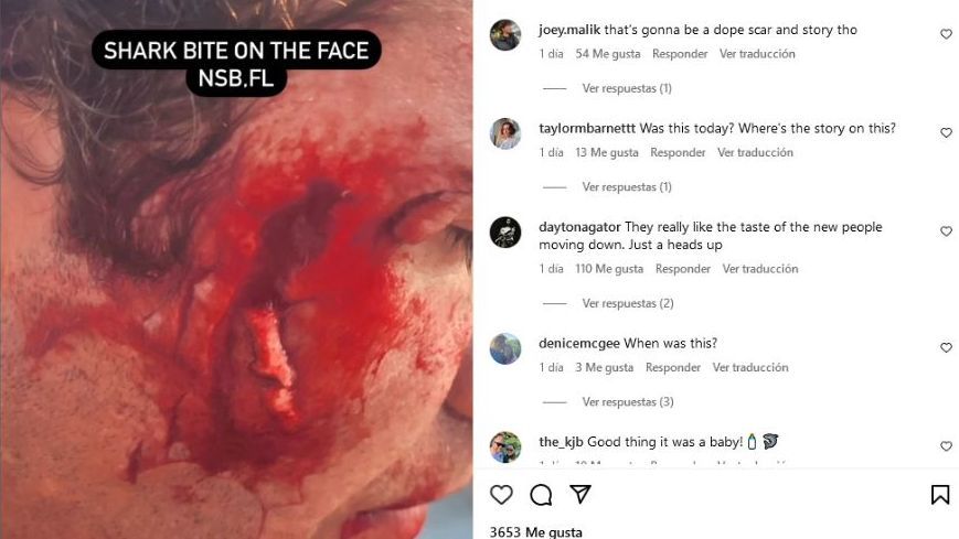 El surfista de 38 años colgó las imágenes de la herida que le provocó el ataque del tiburón