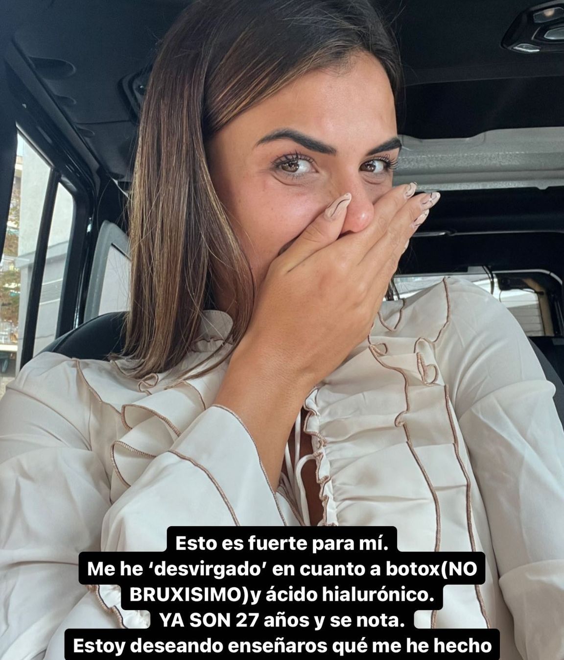 Sofía Suescun, tras retocarse la cara por primera vez