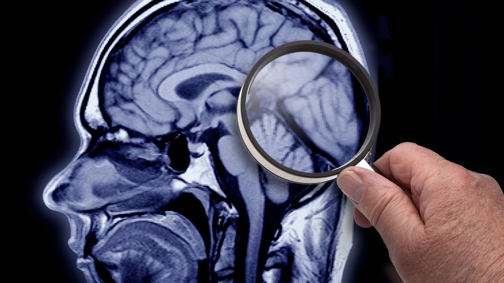 La investigación contra el Alzheimer: "Pronto podremos detectarlo en una analítica, igual que ahora el colesterol o el azúcar"