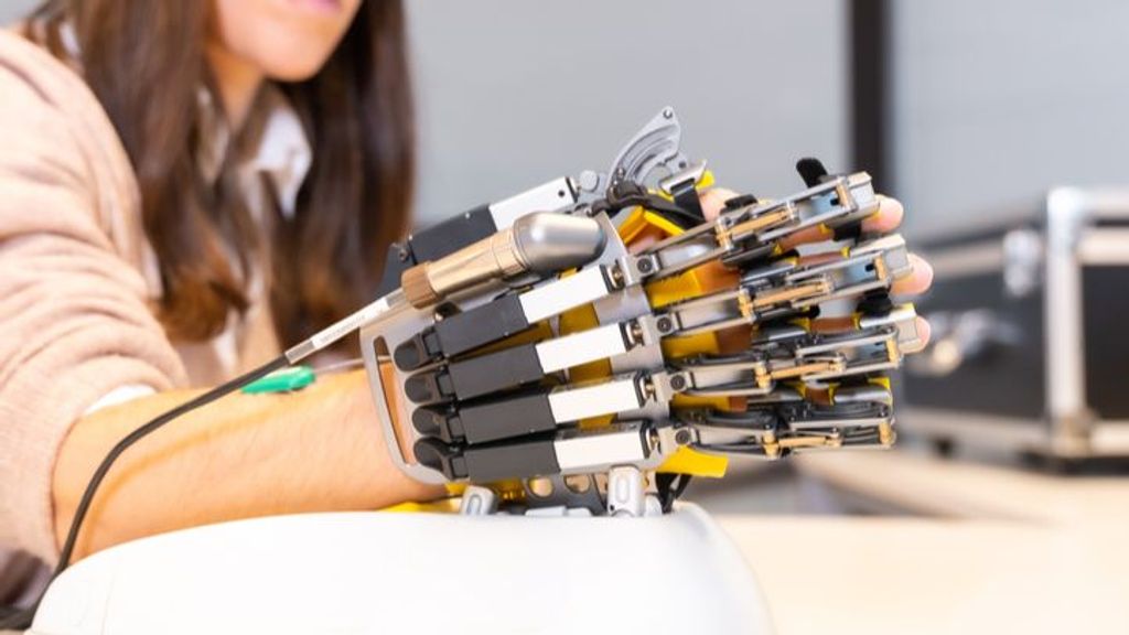Un exoesqueleto de mano, la nueva herramienta que ayuda a mejorar la movilidad de los pacientes covid