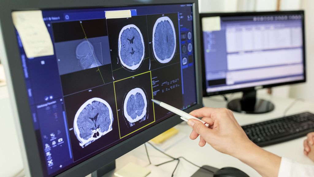 Las cinco cosas a evitar para tener un cerebro sano, según un neurocirujano