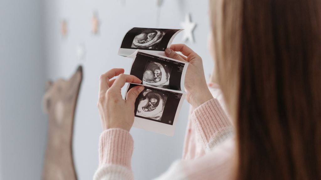 El SOP afecta a las mujeres en edad fértil