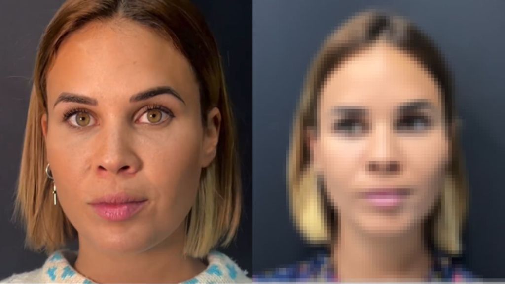 Raquel Arias se somete a una bichectomía: el antes y el después